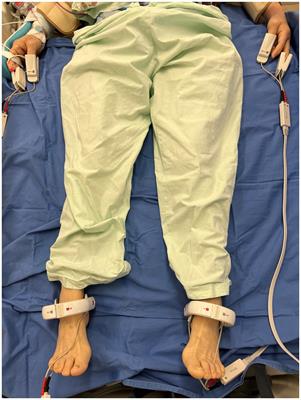 Usefulness of phase angle on bioelectrical impedance analysis as a surveillance tool for postoperative infection in critically ill patients